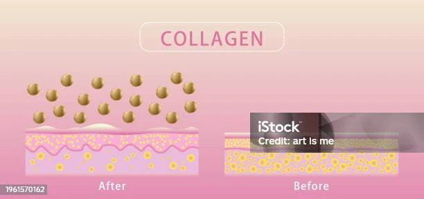 faq-tentang-kolagen-dan-perawatan-kulit - Cara Meningkatkan Produksi Kolagen untuk Kulit Awet Muda