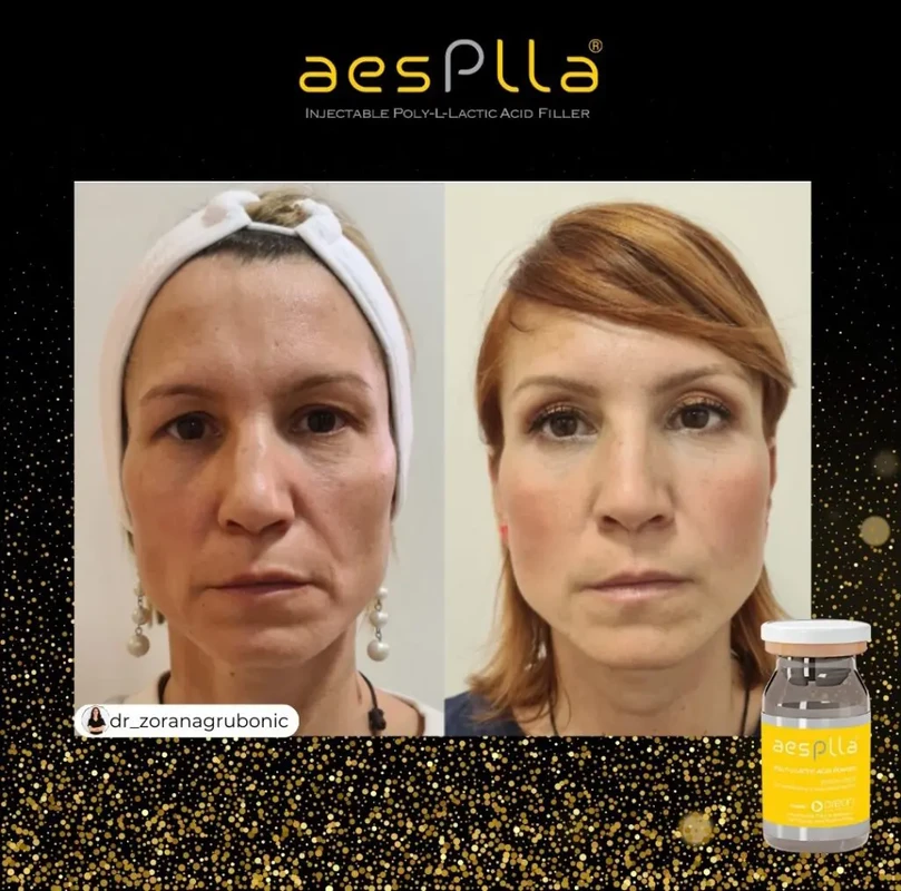 cara-meningkatkan-dan-menjaga-produksi-kolagen - Pengaruh Kekurangan Kolagen pada Kulit dan Cara Mengatasinya