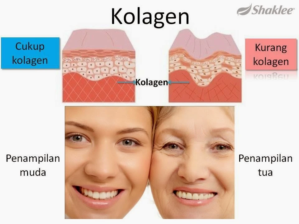 faq-pertanyaan-umum-tentang-kolagen-dan-kesehatan - Perbedaan Kolagen Cukup dan Kekurangan untuk Kulit Sehat