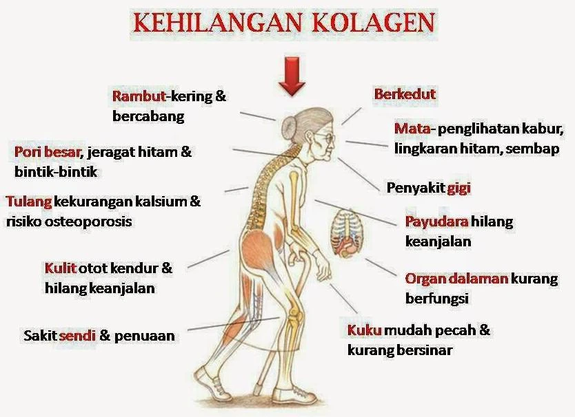 cara-mengatasi-dan-mencegah-kekurangan-kolagen - Cara Mengatasi Kekurangan Kolagen pada Usia Tua Secara Alami