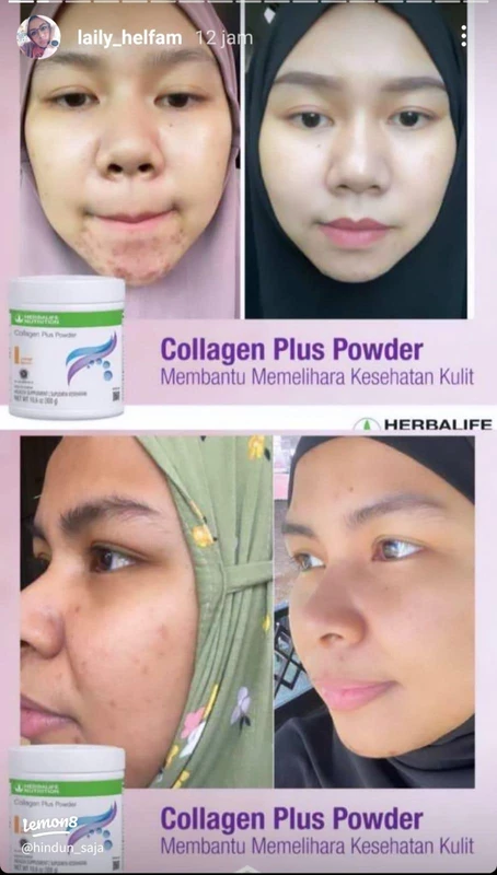 implikasi-dan-langkah-selanjutnya-untuk-atlet - Manfaat Kolagen untuk Atlet: Testimoni dan Cara Mendukung Pemulihan