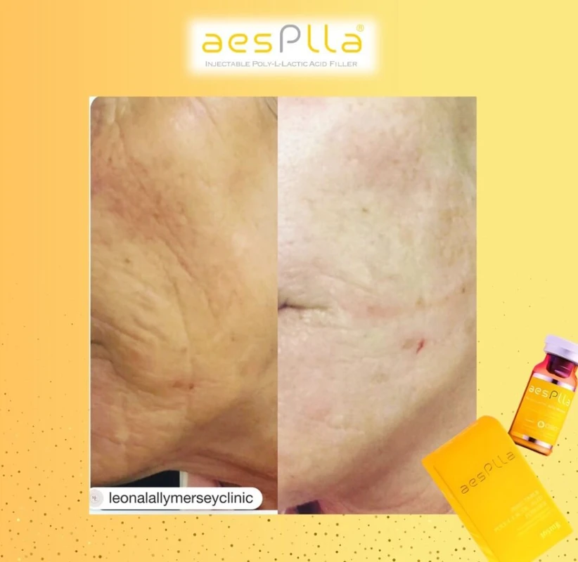 kesimpulan-dan-rekomendasi-kolagen-sebagai-investa - Testimoni Kolagen untuk Perawatan Kulit: Manfaat dan Produk Terbaik