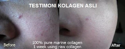 peran-vitamin-c-dan-nutrisi-pendukung-dalam-produk - Testimoni Pengguna Suplemen Kolagen: Manfaat & Dosis Aman Kulit