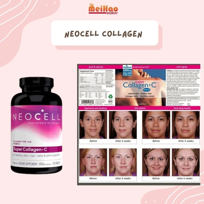 tips-konsumsi-kolagen-yang-efektif-dan-aman - Cara Memilih Produk Kolagen Terbaik untuk Kulit Sehat