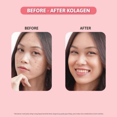 cara-penggunaan-dan-tips-memilih-produk-kolagen - Testimoni Produk Kolagen Wajah dan Manfaatnya Lengkap
