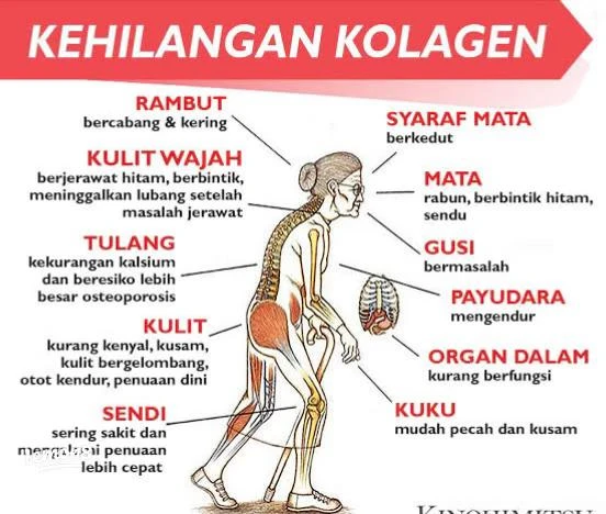 faq-pertanyaan-umum-tentang-kolagen-dan-kesehatan - Efek Kolagen pada Kesehatan Otot dan Sendi: Manfaat Terbukti