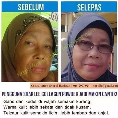 faq-pertanyaan-umum-tentang-suplemen-kolagen - Testimoni Pengguna Produk Kolagen: Manfaat & Risiko Terpercaya