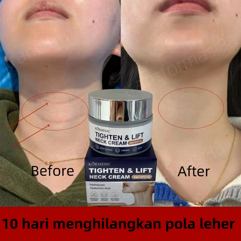 faq-produksi-kolagen-dan-penuaan-kulit - Cara Mempertahankan Produksi Kolagen agar Kulit Awet Muda