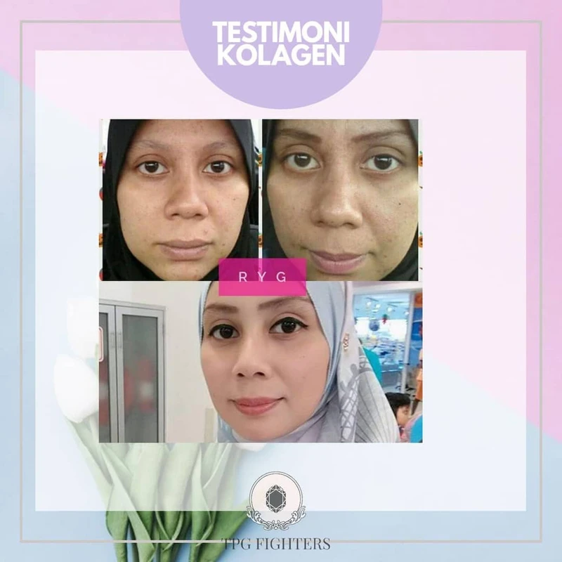 kesimpulan-dan-implikasi-kolagen-dalam-perawatan-k - Testimoni Penggunaan Kolagen: Manfaat untuk Kulit Awet Muda
