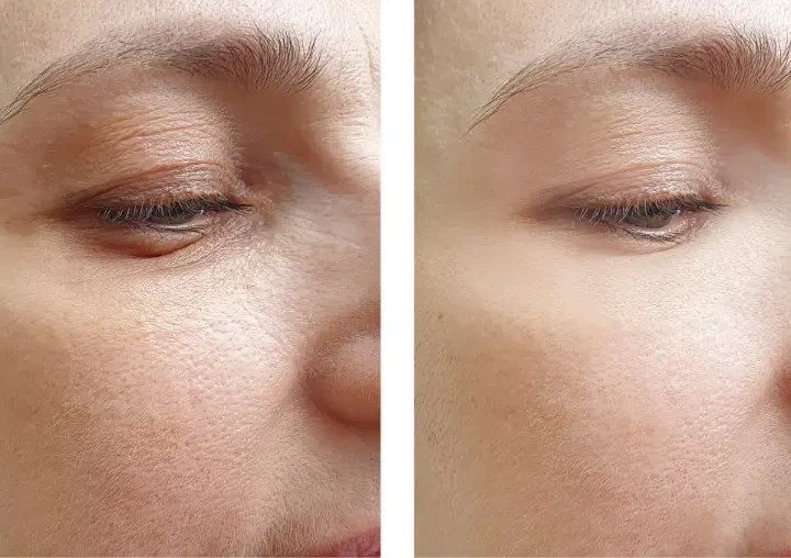 kesimpulan-dan-implikasi-untuk-perawatan-kulit-mas - Cara Menjaga Kolagen dan Cegah Penuaan Kulit Secara Alami