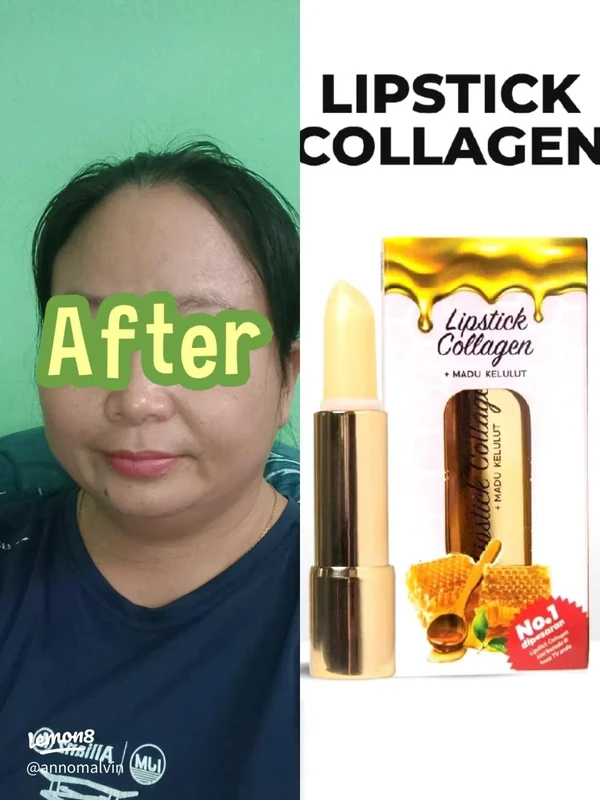 kesimpulan-dan-rekomendasi-pemakaian-kolagen - Testimoni Pengguna Fashion Kolagen: Manfaat dan Risiko Terpercaya