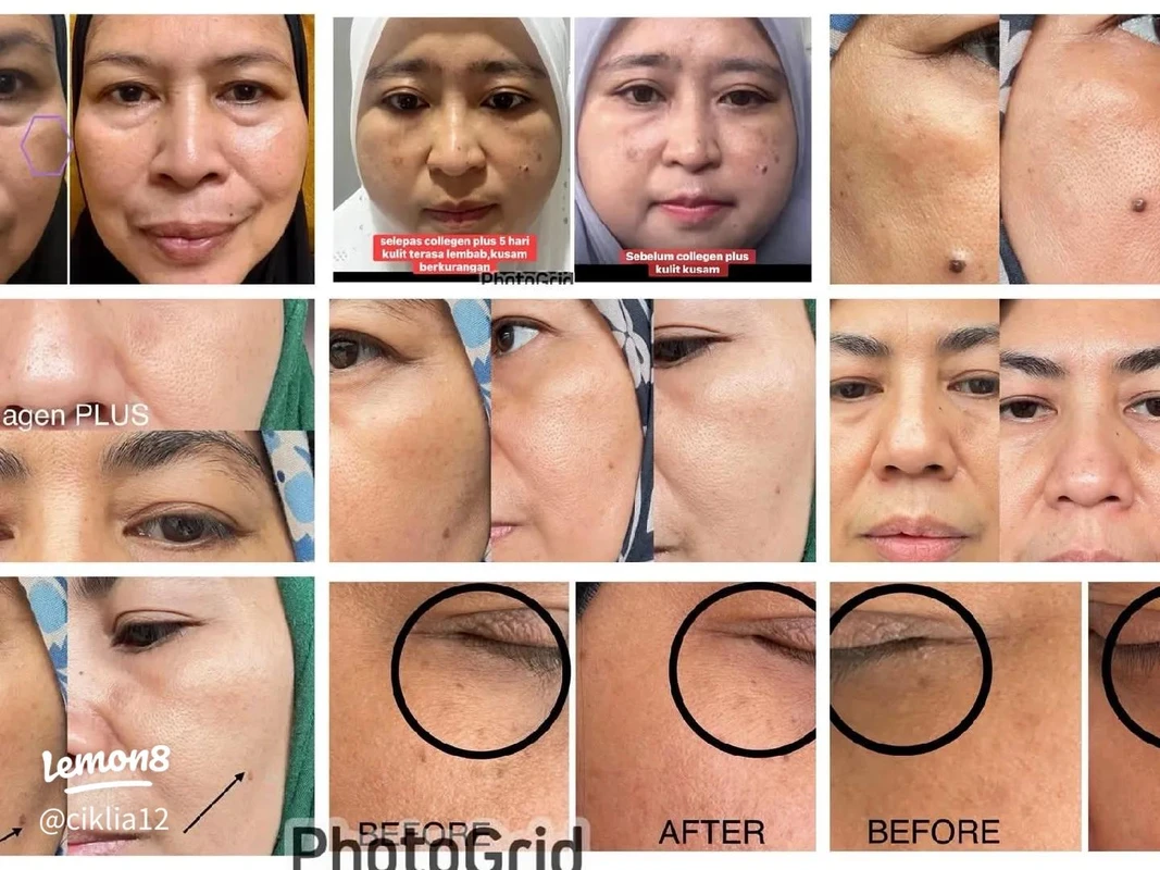 rekomendasi-produk-kolagen-berdasarkan-testimoni - Testimoni Pengguna Fashion Kolagen: Manfaat dan Risiko Terpercaya