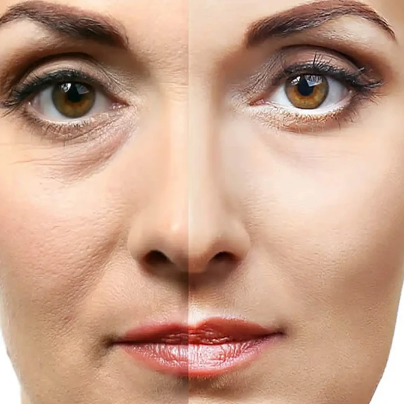 tips-memaksimalkan-hasil-perawatan-kolagen - Cara Efektif Menggunakan Kolagen untuk Memperbaiki Kerutan Wajah