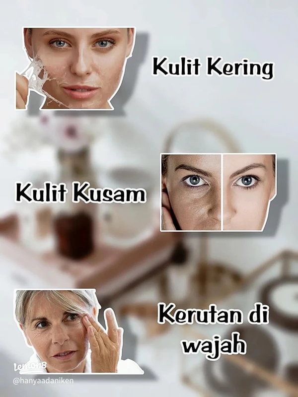 upaya-pencegahan-dan-perawatan-kekurangan-kolagen - Cara Diagnosis Kekurangan Kolagen dan Tanda Fisiknya