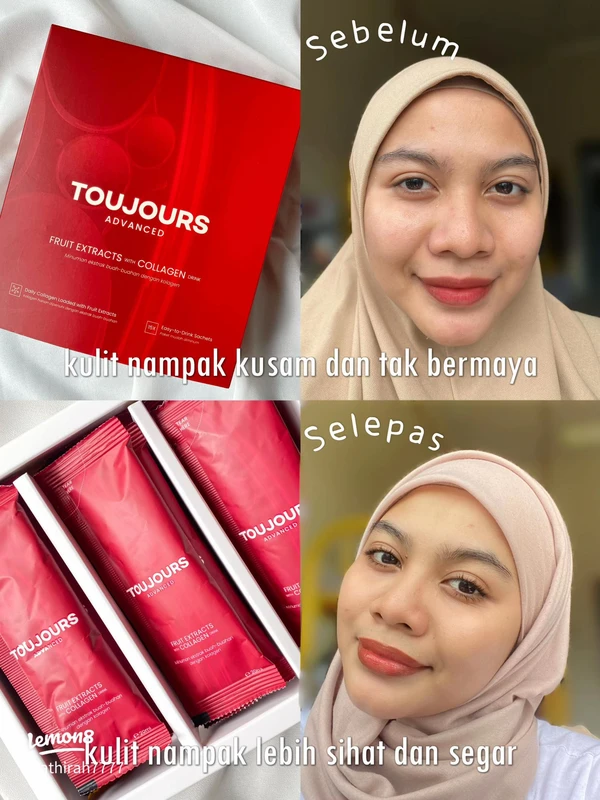 faq-pertanyaan-umum-tentang-kolagen-dan-pasar-keca - Peran Kolagen dan Perubahan Pasar Kecantikan Terbaru