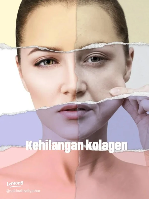 implikasi-perubahan-pasar-dan-peluang-industri - Peran Kolagen dan Perubahan Pasar Kecantikan Terbaru