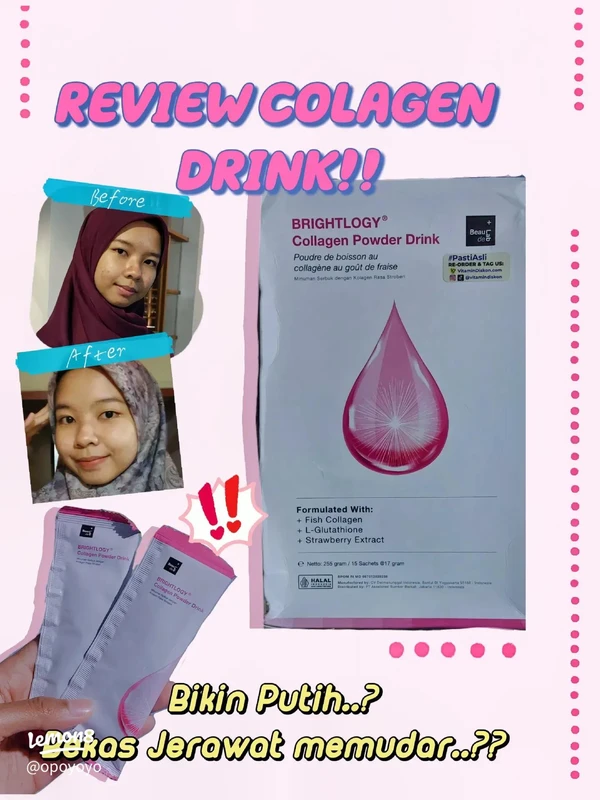 kesimpulan-dan-rekomendasi-praktis - Cara Kolagen Mempercepat Pemulihan Kulit Setelah Jerawat