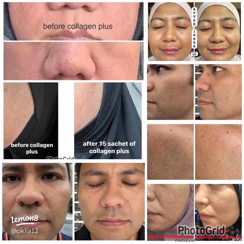 Perbandingan Produk Fashion Kolagen Terbaik untuk Kulit Awet Muda